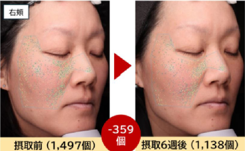 右頬摂取前と摂取後の肌表面の凹凸の写真2